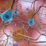 A vérvizsgálat korán jelezheti az Alzheimer-kór kockázatát. De mennyire megbízható?